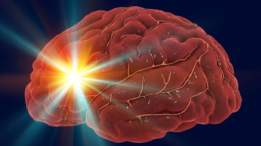 Невролог озвучил причину негативного влияния COVID-19 на клетки головного мозга