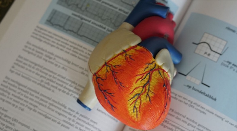 Преэклампсия предрасполагает к развитию инфаркта миокарда