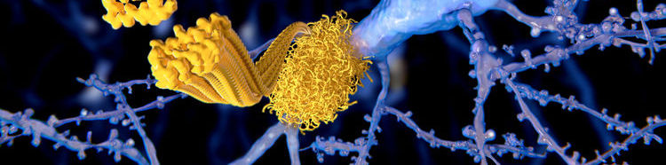 белок CD33 спасет человечество от болезни Альцгеймера