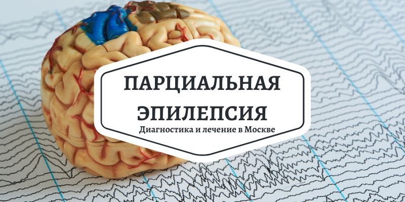 Диагностика парциальной эпилепсии. Лечение недорого в Москве